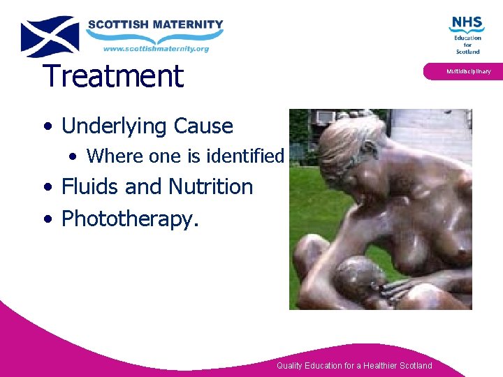 Treatment Multidisciplinary • Underlying Cause • Where one is identified • Fluids and Nutrition