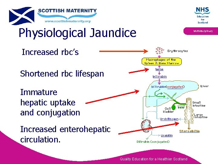 Physiological Jaundice Increased rbc’s Shortened rbc lifespan Immature hepatic uptake and conjugation Increased enterohepatic