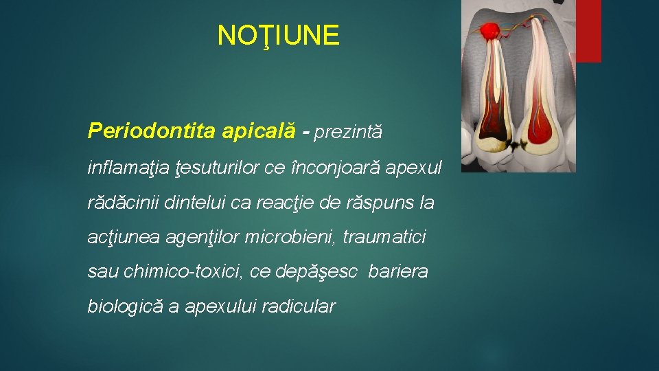 NOŢIUNE Periodontita apicală - prezintă inflamaţia ţesuturilor ce înconjoară apexul rădăcinii dintelui ca NOŢIUNE Periodontita apicală - prezintă inflamaţia ţesuturilor ce înconjoară apexul rădăcinii dintelui ca