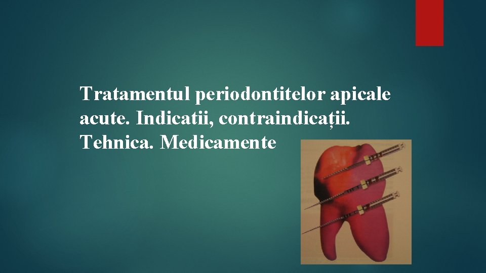 Tratamentul periodontitelor apicale acute. Indicatii, contraindicații. Tehnica. Medicamente 