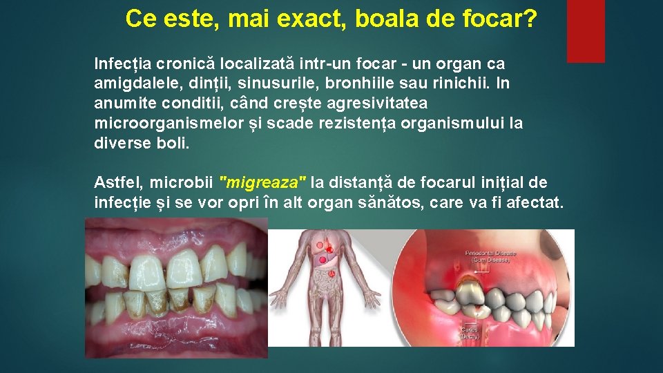 Ce este, mai exact, boala de focar? Infecția cronică localizată intr-un focar - un Ce este, mai exact, boala de focar? Infecția cronică localizată intr-un focar - un