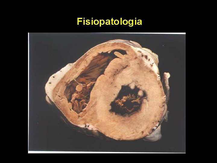 Fisiopatologia Fisiopatologia