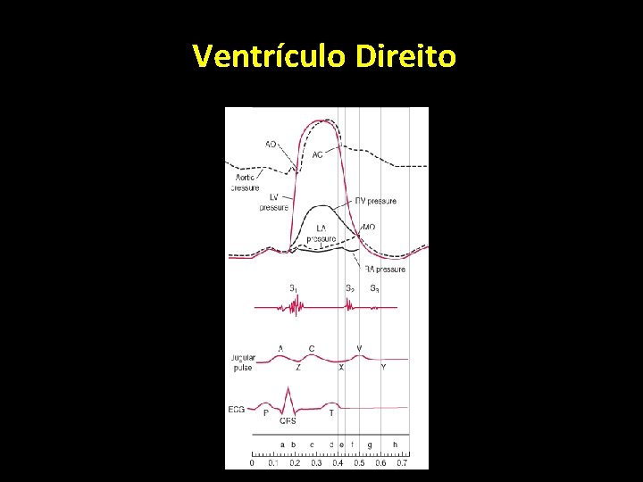Ventrículo Direito Ventrículo Direito