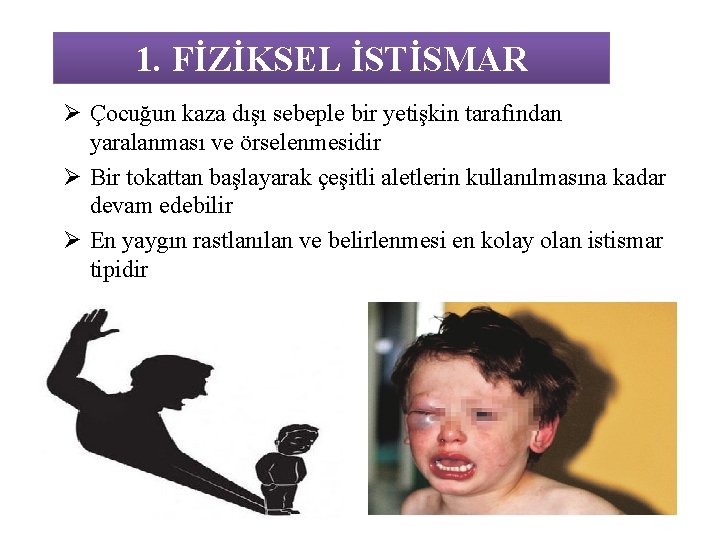 1. FİZİKSEL İSTİSMAR Ø Çocuğun kaza dışı sebeple bir yetişkin tarafından yaralanması ve örselenmesidir