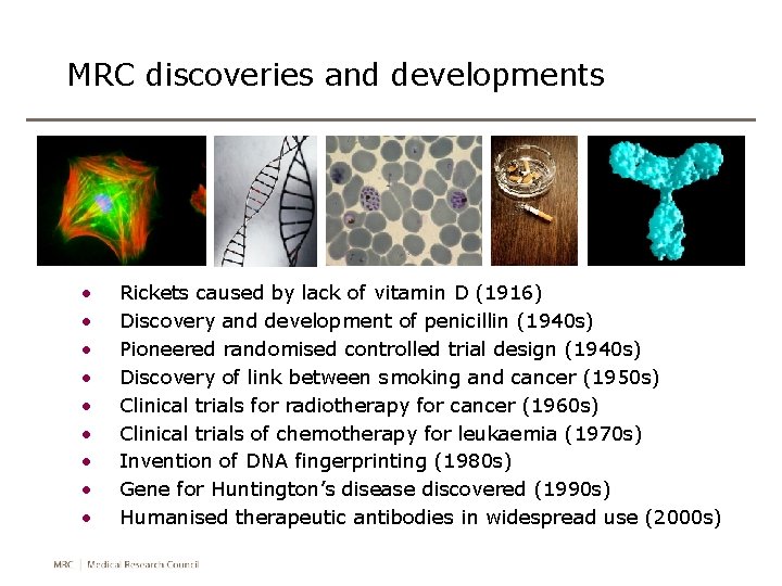 MRC discoveries and developments • • • Rickets caused by lack of vitamin D