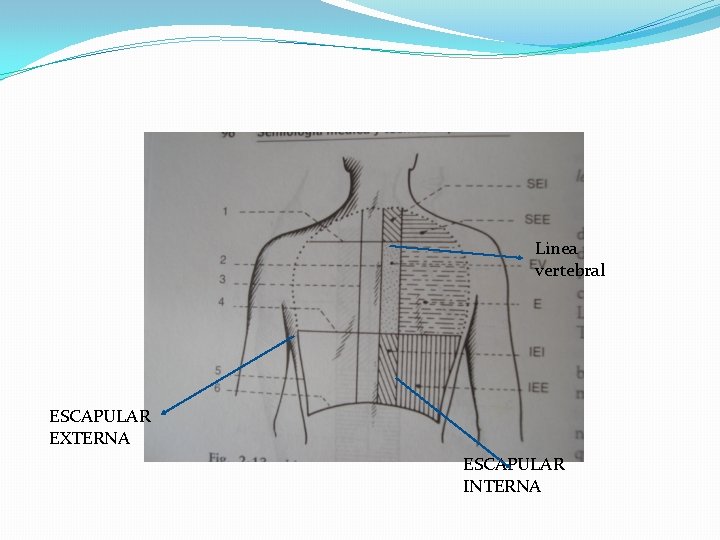 Linea vertebral ESCAPULAR EXTERNA ESCAPULAR INTERNA 