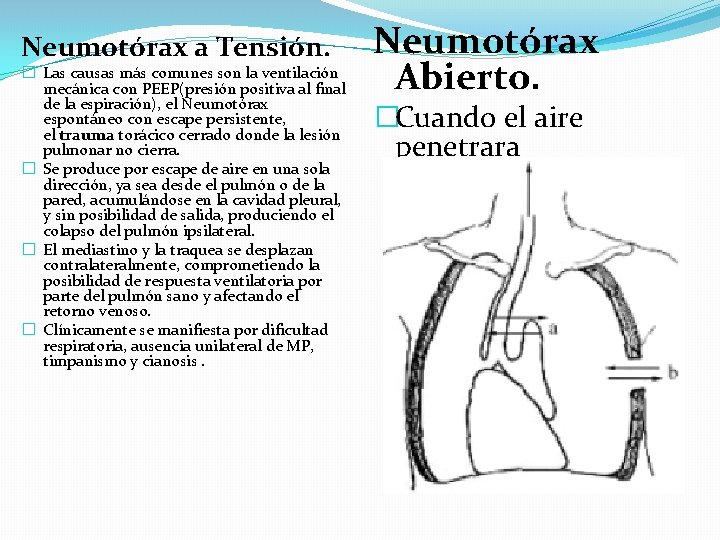 Neumotórax a Tensión. � Las causas más comunes son la ventilación mecánica con PEEP(presión