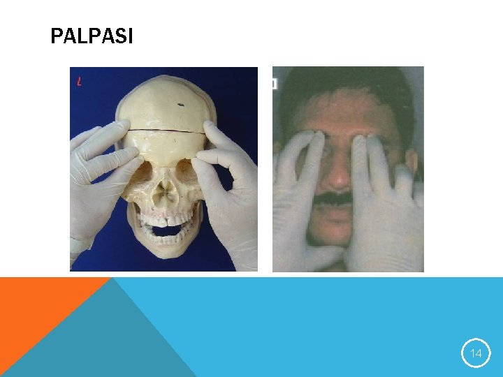 PALPASI 14 