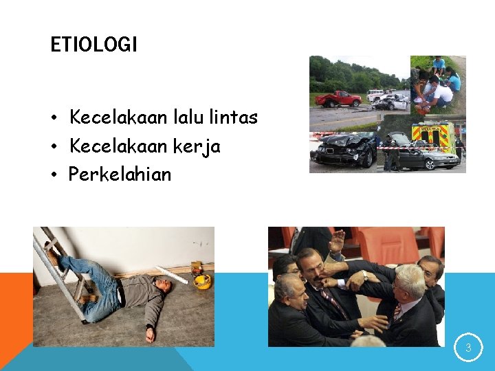 ETIOLOGI • Kecelakaan lalu lintas • Kecelakaan kerja • Perkelahian 3 