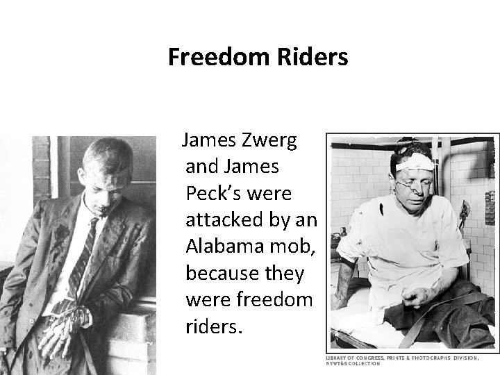 Freedom Riders James Zwerg and James Peck’s were attacked by an Alabama mob, because