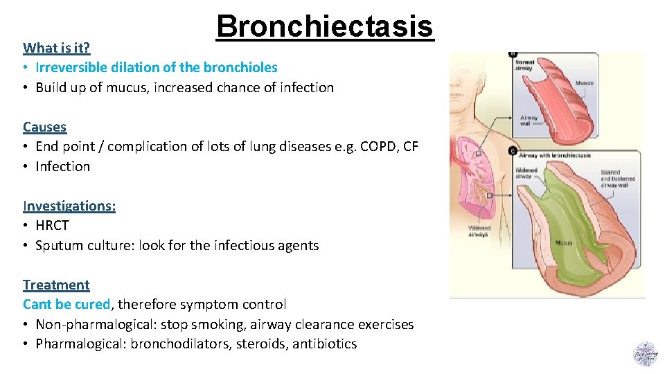 Bronchiectasis What is it? • Irreversible dilation of the bronchioles • Build up of