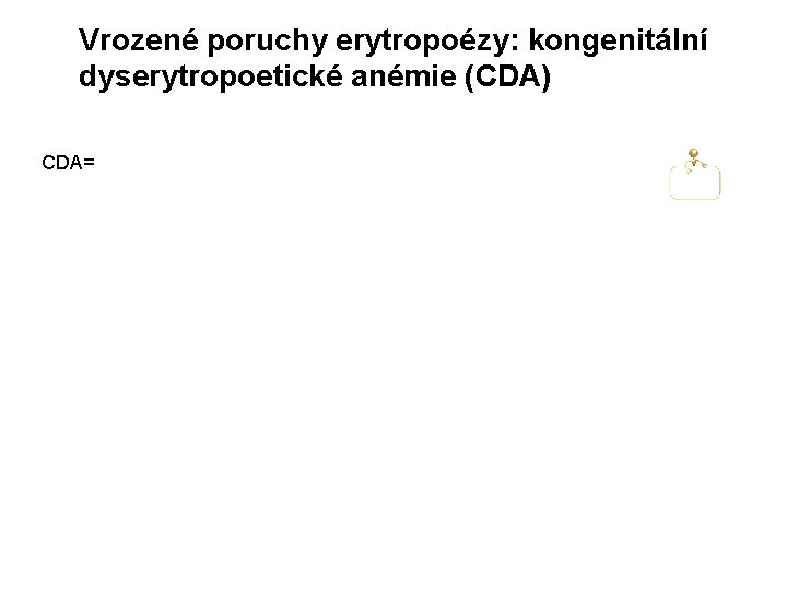 Vrozené poruchy erytropoézy: kongenitální dyserytropoetické anémie (CDA) CDA= 