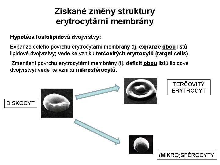 Získané změny struktury erytrocytární membrány Hypotéza fosfolipidová dvojvrstvy: Expanze celého povrchu erytrocytární membrány (tj.