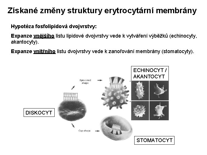 Získané změny struktury erytrocytární membrány Hypotéza fosfolipidová dvojvrstvy: Expanze vnějšího listu lipidové dvojvrstvy vede