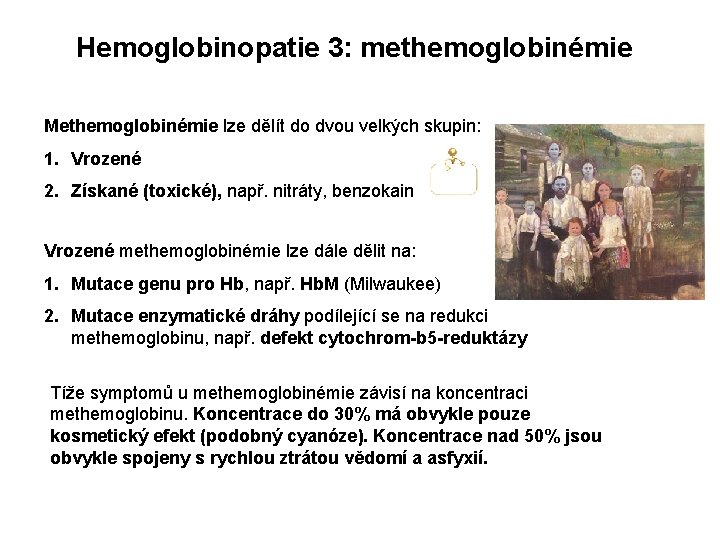 Hemoglobinopatie 3: methemoglobinémie Methemoglobinémie lze dělít do dvou velkých skupin: 1. Vrozené 2. Získané