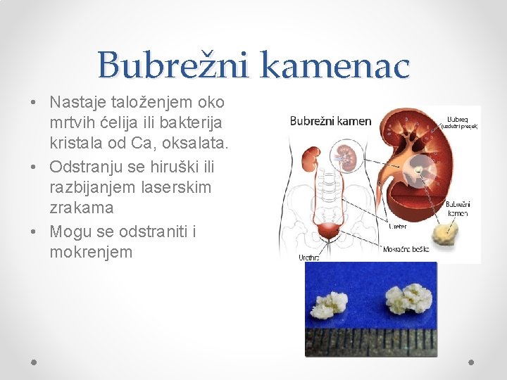 Bolesti organa za ekskreciju Organi za ekskreciju Organi