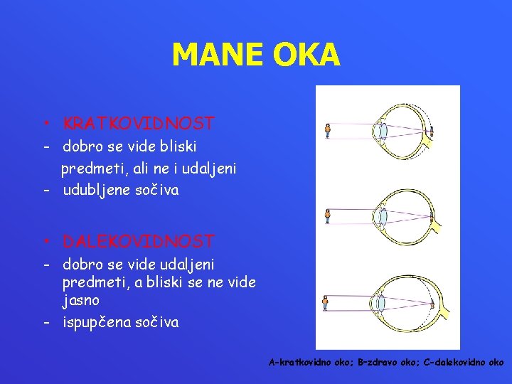 MANE OKA • KRATKOVIDNOST - dobro se vide bliski predmeti, ali ne i udaljeni