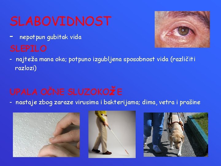 SLABOVIDNOST - nepotpun gubitak vida SLEPILO - najteža mana oka; potpuno izgubljena sposobnost vida