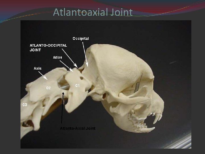 Atlantoaxial Joint Atlanto-Axial Joint 