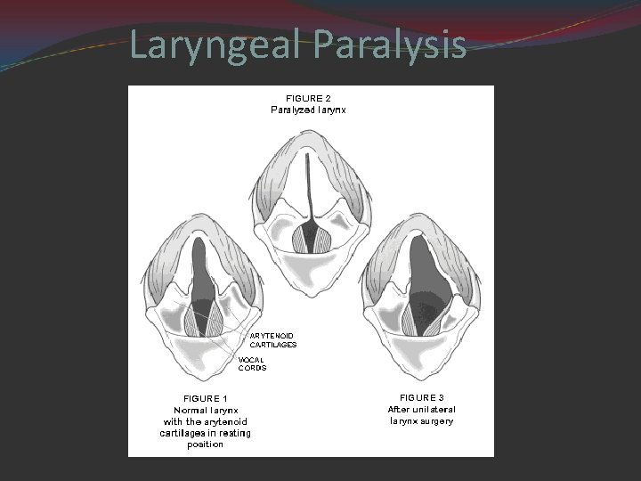 Laryngeal Paralysis 