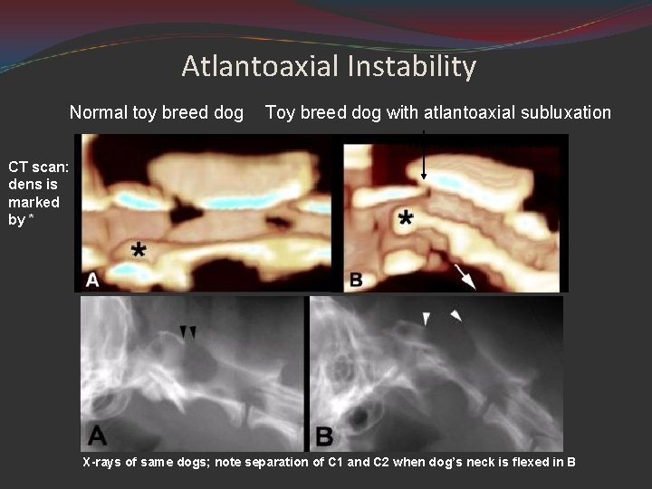 Atlantoaxial Instability Normal toy breed dog Toy breed dog with atlantoaxial subluxation Narrowed spinal