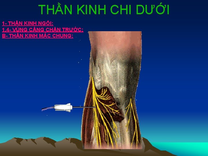 THẦN KINH CHI DƯỚI 1 - THẦN KINH NGỒI: 1. 4 - VÙNG CẲNG