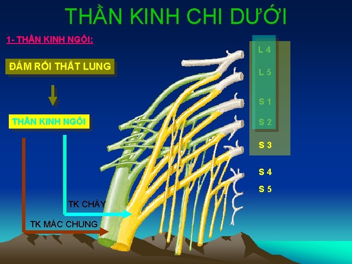 THẦN KINH CHI DƯỚI 1 - THẦN KINH NGỒI: L 4 ĐÁM RỐI THẮT