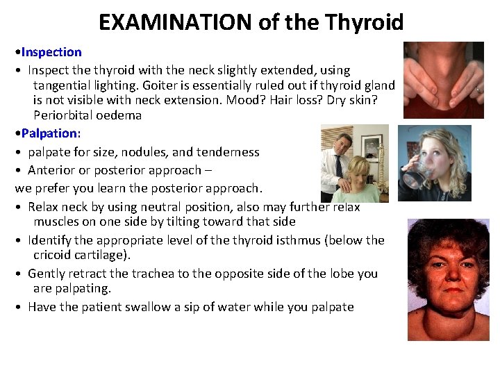 EXAMINATION of the Thyroid • Inspection • Inspect the thyroid with the neck slightly