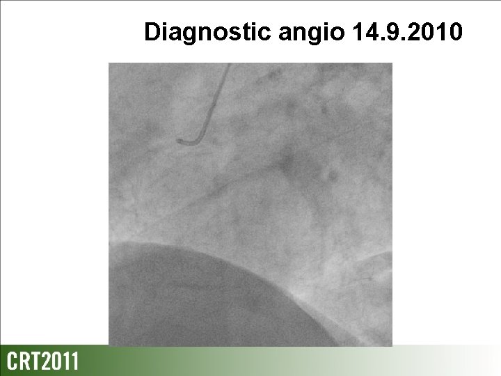 Diagnostic angio 14. 9. 2010 