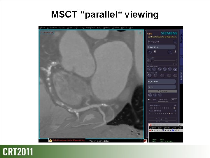 MSCT “parallel“ viewing 