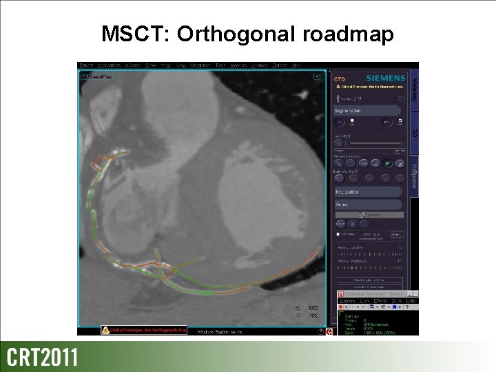 MSCT: Orthogonal roadmap 