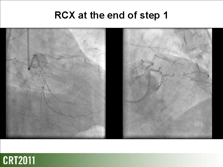 RCX at the end of step 1 