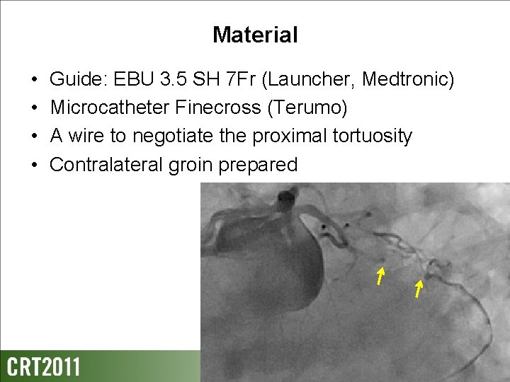 Material • • Guide: EBU 3. 5 SH 7 Fr (Launcher, Medtronic) Microcatheter Finecross