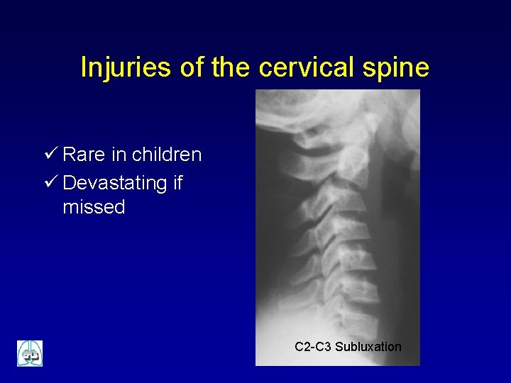 Injuries of the cervical spine ü Rare in children ü Devastating if missed C