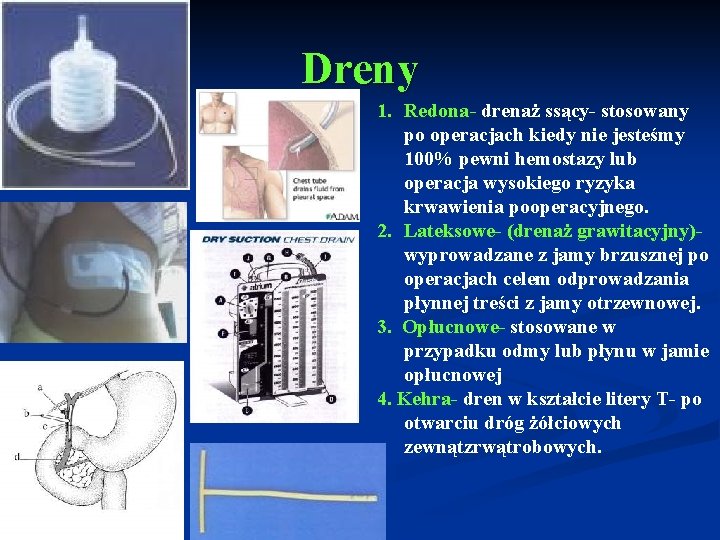 Dreny 1. Redona- drenaż ssący- stosowany po operacjach kiedy nie jesteśmy 100% pewni hemostazy
