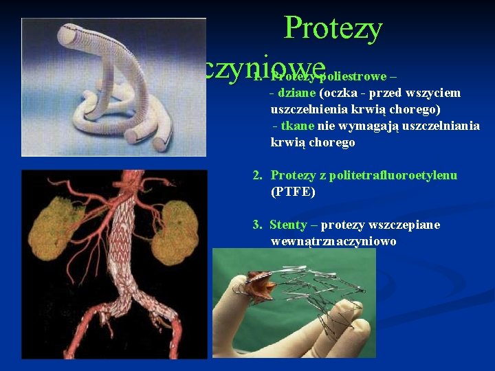 Protezy naczyniowe 1. Protezy poliestrowe – - dziane (oczka - przed wszyciem uszczelnienia krwią