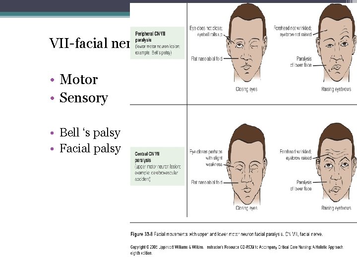 VII-facial nerve • Motor • Sensory • Bell ‘s palsy • Facial palsy VII-facial nerve • Motor • Sensory • Bell ‘s palsy • Facial palsy