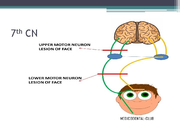 7 th CN 7 th CN