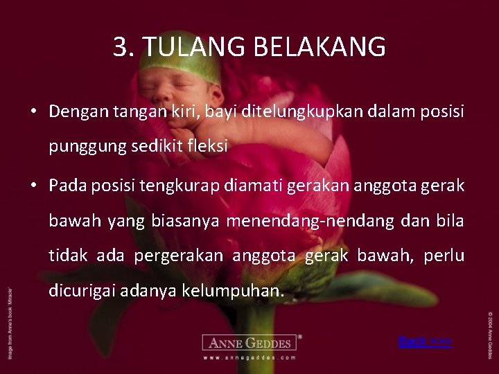 3. TULANG BELAKANG • Dengan tangan kiri, bayi ditelungkupkan dalam posisi punggung sedikit fleksi