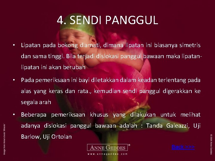 4. SENDI PANGGUL • Lipatan pada bokong diamati, dimana lipatan ini biasanya simetris dan