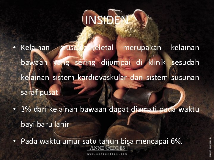 INSIDEN • Kelainan musculoskeletal merupakan kelainan bawaan yang sering dijumpai di klinik sesudah kelainan