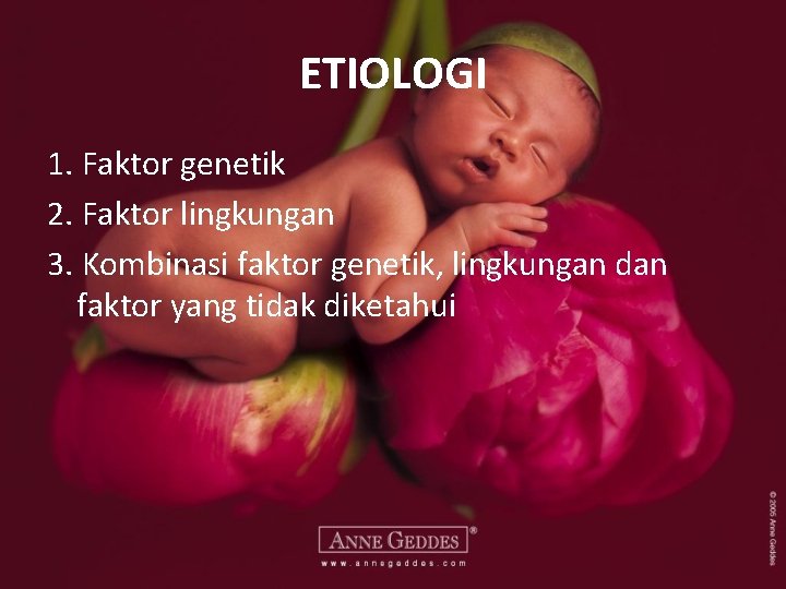 ETIOLOGI 1. Faktor genetik 2. Faktor lingkungan 3. Kombinasi faktor genetik, lingkungan dan faktor