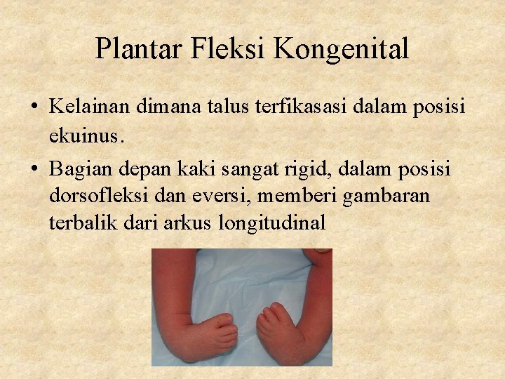 Plantar Fleksi Kongenital • Kelainan dimana talus terfikasasi dalam posisi ekuinus. • Bagian depan
