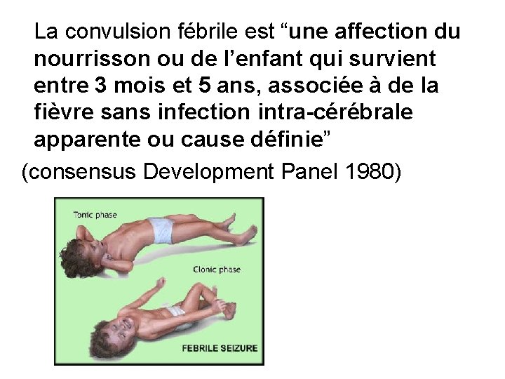 La convulsion fébrile est “une affection du nourrisson ou de l’enfant qui survient entre