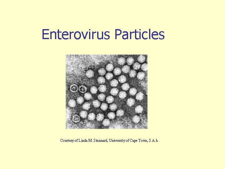 Enterovirus Particles Courtesy of Linda M. Stannard, University of Cape Town, S. A. h