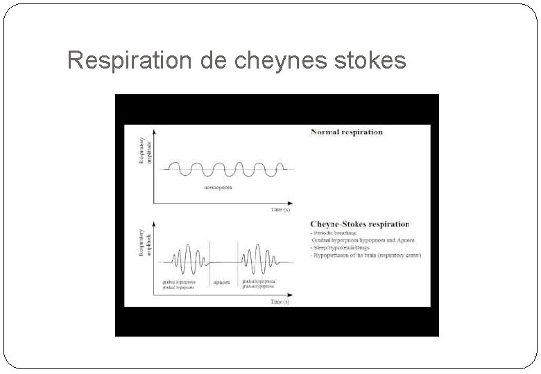 Respiration de cheynes stokes 