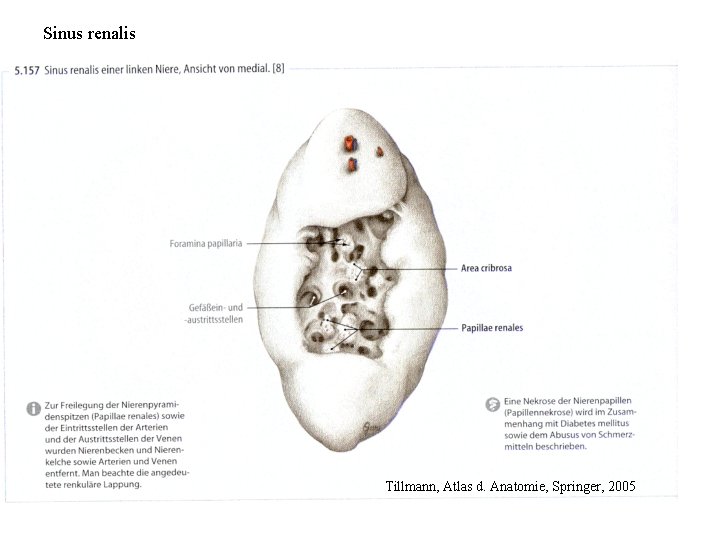 Sinus renalis Tillmann, Atlas d. Anatomie, Springer, 2005 