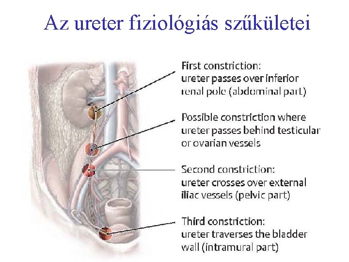 Az ureter fiziológiás szűkületei 