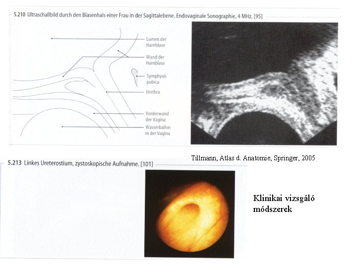 Tillmann, Atlas d. Anatomie, Springer, 2005 Klinikai vizsgáló módszerek 