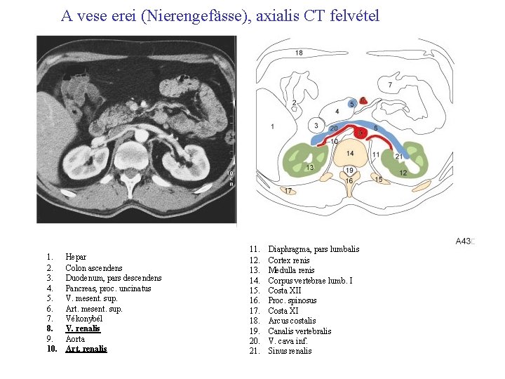 A vese erei (Nierengefässe), axialis CT felvétel 1. 2. 3. 4. 5. 6. 7.